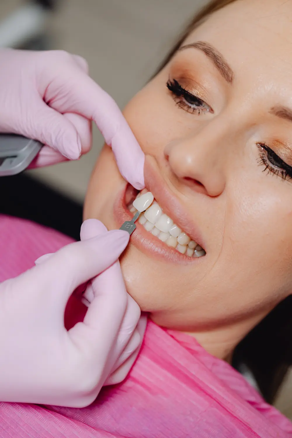 Ein Zahnarzt, der einem Patienten einen Veneer-Zahn anbringt